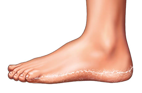 uncontrolled itching in arch of foot | Foot Health Forum